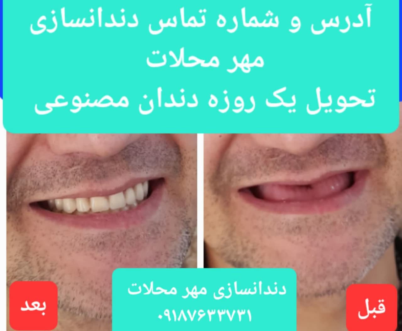 شماره تلفن دندانسازی محلات