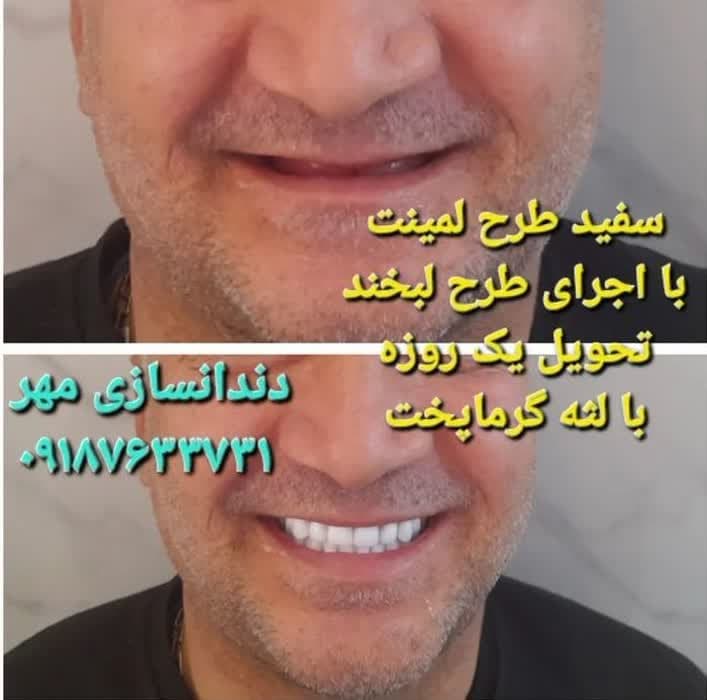 دندان سازی محلات