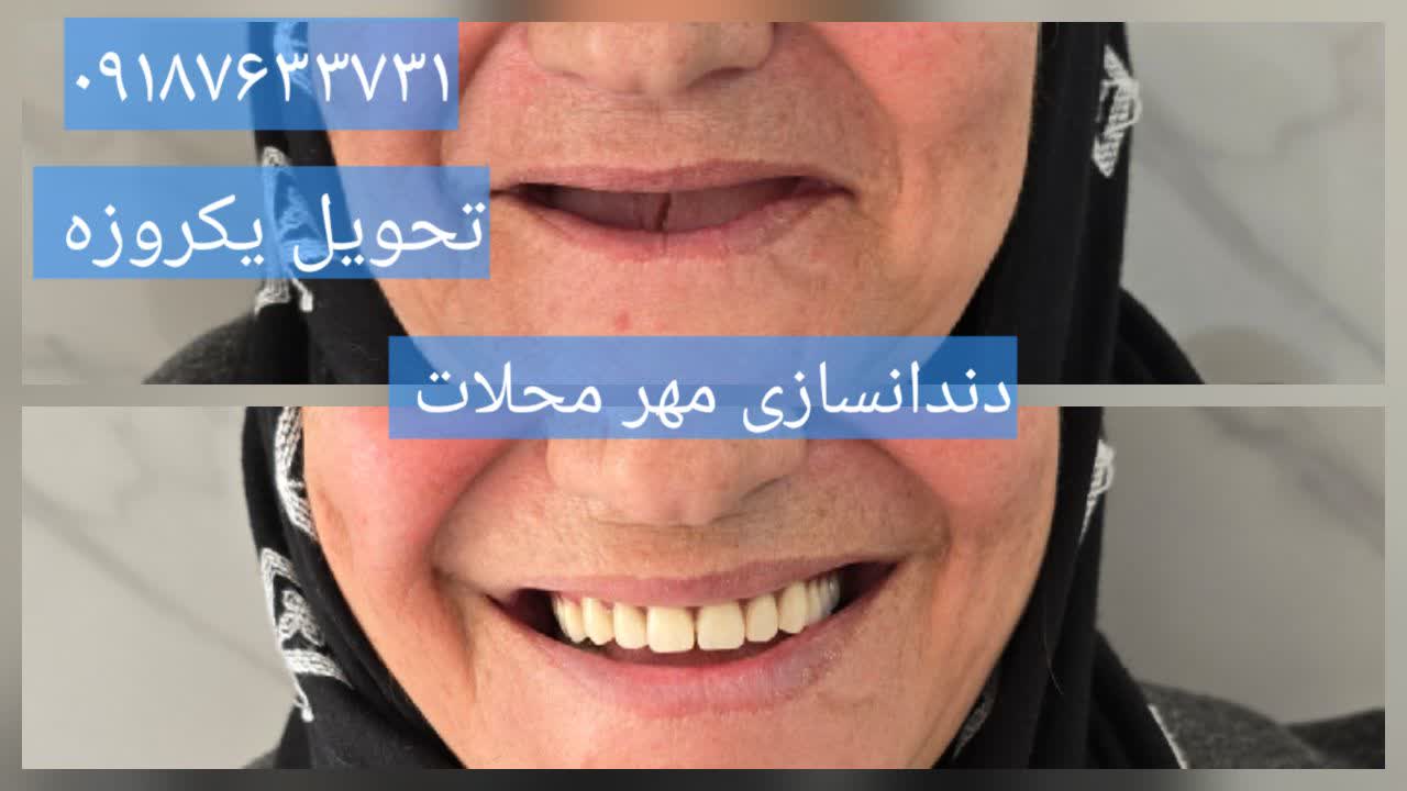 دندانسازی محلات دندانسازی مهر محلات